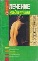 Книга Лечение радикулита 1999 Л. Владимирова Минск Мягкая обл. 191 с. Без илл.